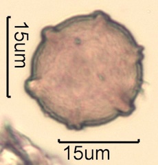 Canadian Honey Pollen Under the Microscope
