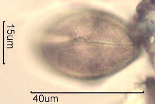 Canadian Honey Pollen Under the Microscope