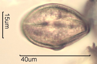 Canadian Honey Pollen Under the Microscope