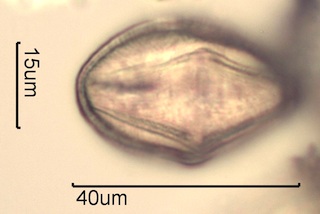 Canadian Honey Pollen Under the Microscope