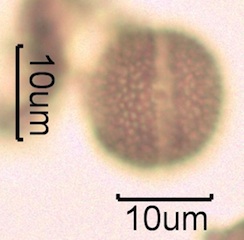 Canadian Honey Pollen Under the Microscope