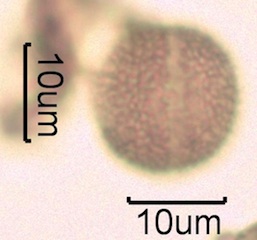 Canadian Honey Pollen Under the Microscope