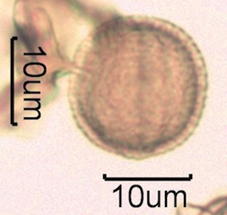 Canadian Honey Pollen Under the Microscope