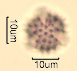 Canadian Honey Pollen Under the Microscope