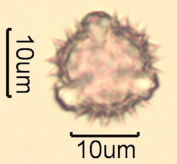 Canadian Honey Pollen Under the Microscope