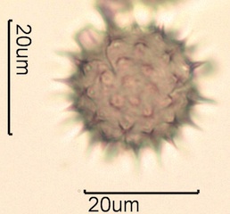 Canadian Honey Pollen Under the Microscope
