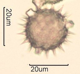 Canadian Honey Pollen Under the Microscope