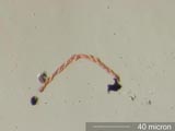 Slime Mold Capillitium