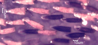 Carpet Beetle Scales