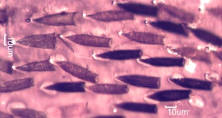 Carpet Beetle Scales