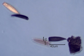 Carpet Beetle Scales