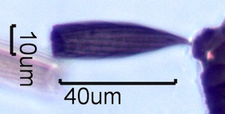 Carpet Beetle Scales