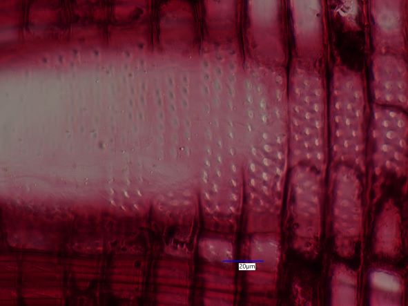Carya ovata, Radial Section