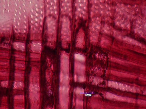 Carya ovata, Radial Section