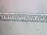 Cat-Tabby 1d Medula Structure