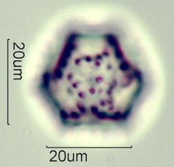 Cat's Ear (Hypochaeris radicata) Pollen