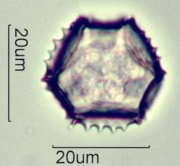 Cat's Ear (Hypochaeris radicata) Pollen
