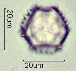 Cat's Ear (Hypochaeris radicata) Pollen