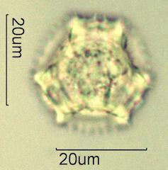 Cat's Ear (Hypochaeris radicata) Pollen