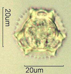 Cat's Ear (Hypochaeris radicata) Pollen