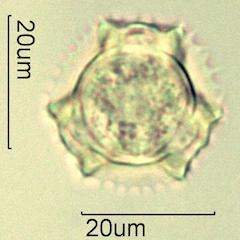 Cat's Ear (Hypochaeris radicata) Pollen