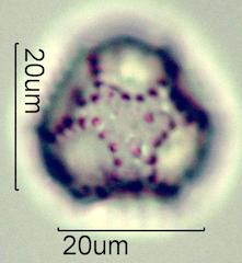 Cat's Ear (Hypochaeris radicata) Pollen