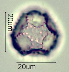 Cat's Ear (Hypochaeris radicata) Pollen