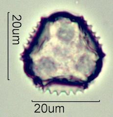 Cat's Ear (Hypochaeris radicata) Pollen