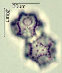 Cat's Ear (Hypochaeris radicata) Pollen