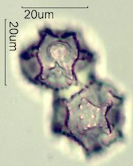 Cat's Ear (Hypochaeris radicata) Pollen