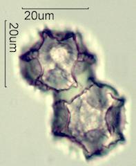 Cat's Ear (Hypochaeris radicata) Pollen