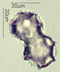 Cat's Ear (Hypochaeris radicata) Pollen