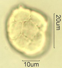 Acacia Pollen