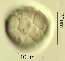 Acacia Pollen