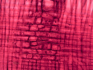 Celtus occidentalus, Radial-Section