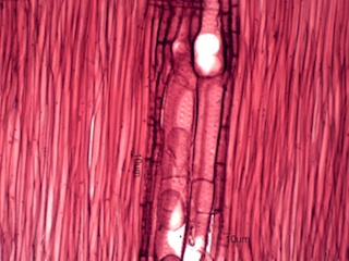 Celtus occidentalus, Radial-Section