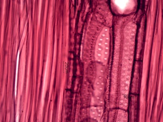 Celtus occidentalus, Radial-Section