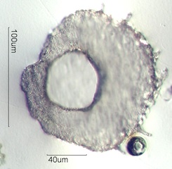 Centropyxis aculeata