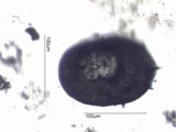 Centropyxis aculeata