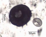 Centropyxis aculeata and Arcella vulgaris