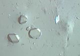 Cesium Alum Test for Aluminum