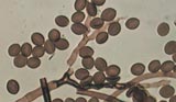Chaetomium
