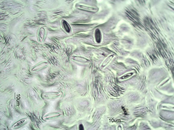 Stomata Under The Microscope