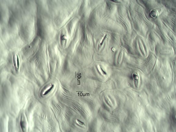 Stomata Under The Microscope