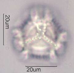 Chicory (Cichorium intybus) Pollen under the Microscope