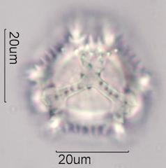 Chicory (Cichorium intybus) Pollen under the Microscope