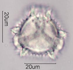Chicory (Cichorium intybus) Pollen under the Microscope