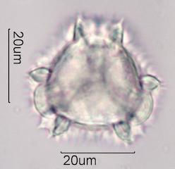 Chicory (Cichorium intybus) Pollen under the Microscope
