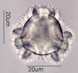 Chicory (Cichorium intybus) Pollen under the Microscope