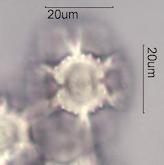 Chicory (Cichorium intybus) Pollen under the Microscope